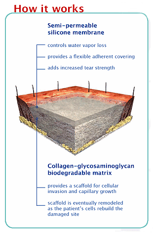Bi-Layer Membrane System