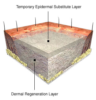 Bi-Layer Membrane System